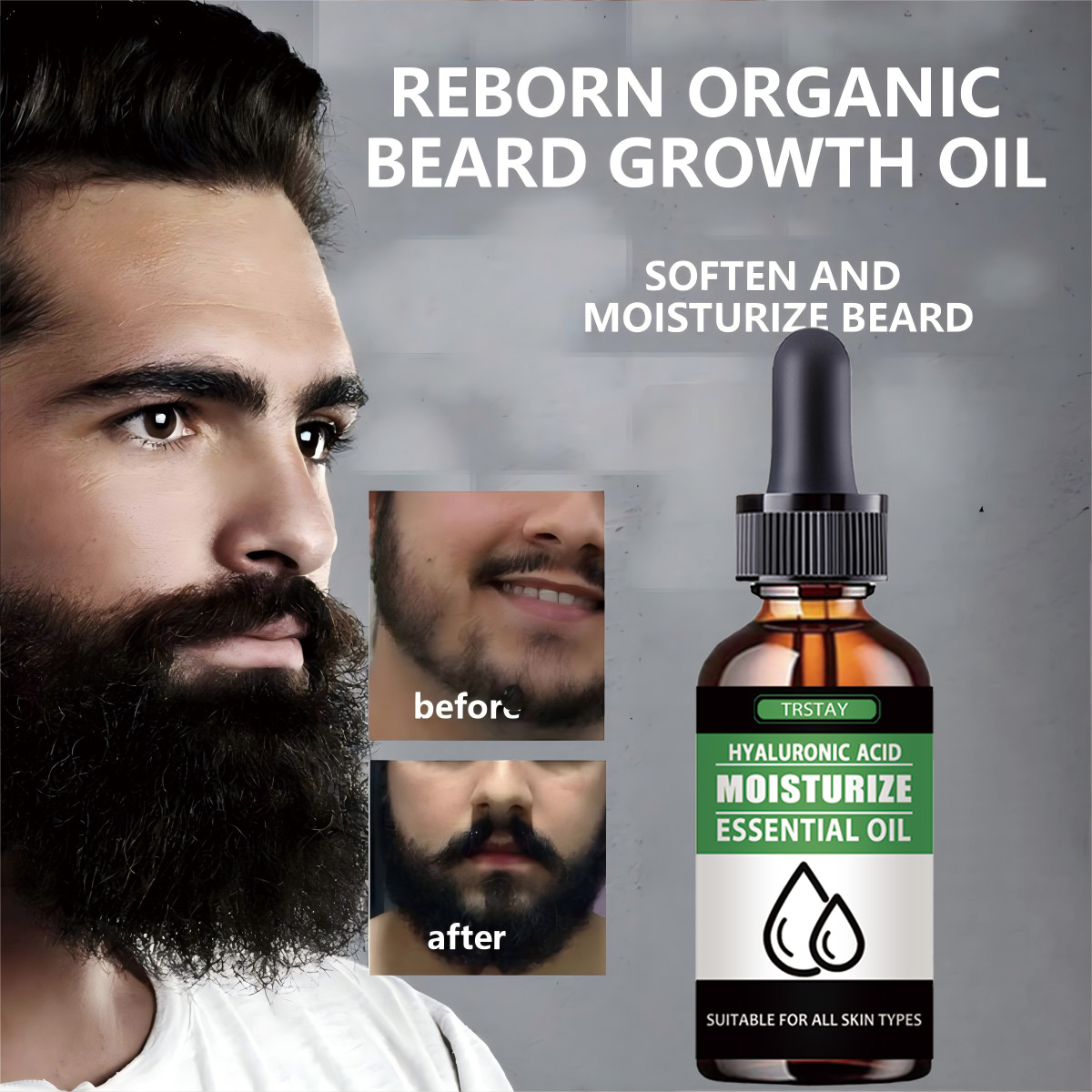 Men'S Grooming Products - 100%Natural Accelerate Facial Hair Grow Beard